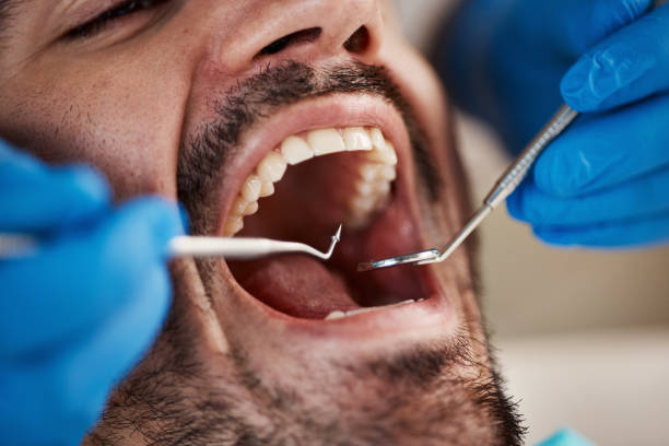 Best Emergency Cosmetic Dentistry (e.g., broken veneers) in Milford, IN